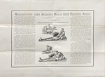 Resuscitation From Electric Shock 1904 by U.S. Naval War College Archives